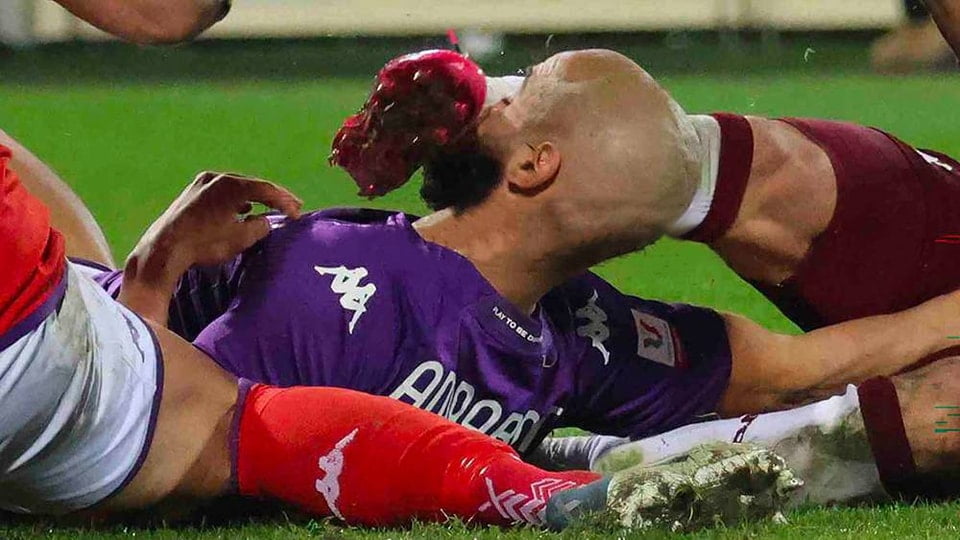 سفيان أمرابط يتلقى ضربة قوية على الوجه تتسبب بكسر أنفه 1 سفيان أمرابط يتلقى ضربة قوية على الوجه تتسبب بكسر أنفه